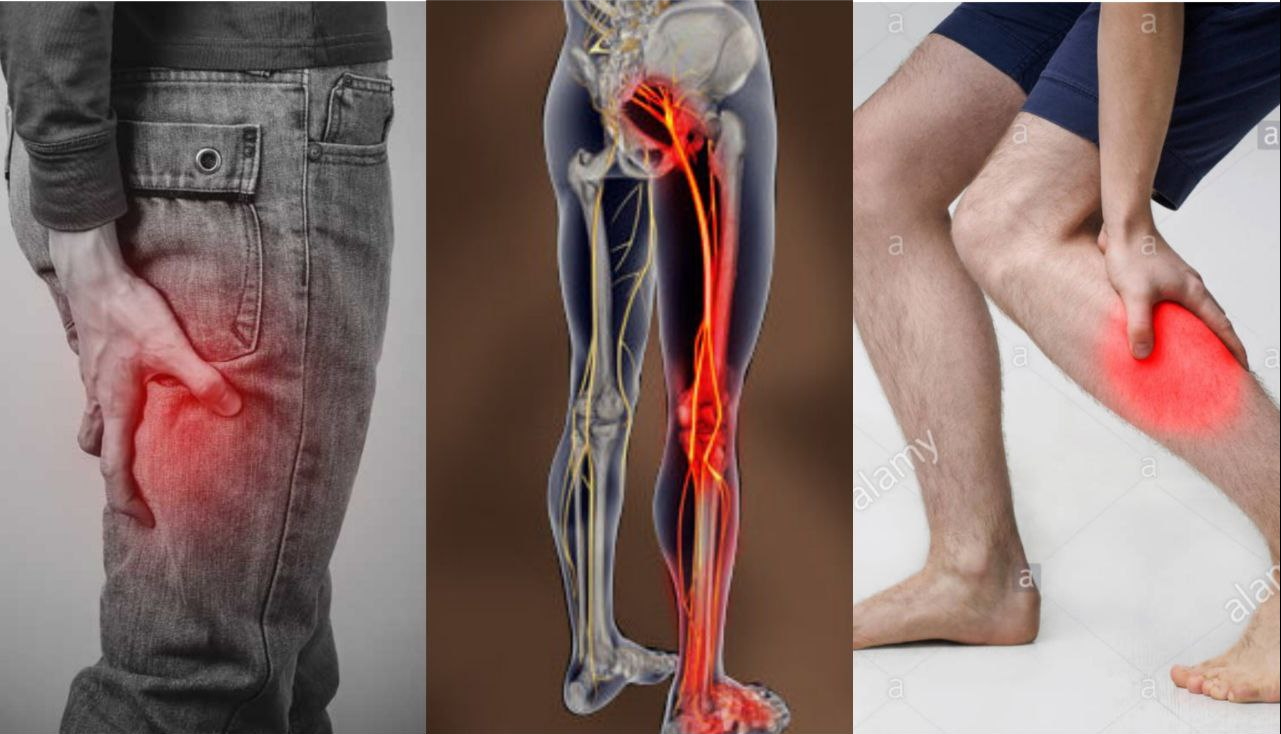 مجله گردشگری ألم عرق النسا                                         Sciatica Pain 